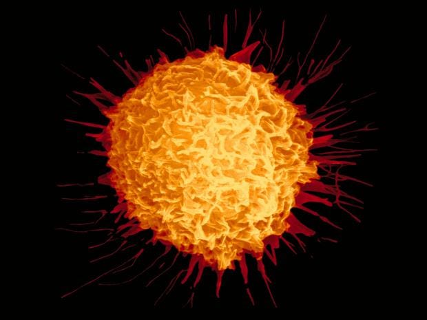 Prostate-cancer-cell.jpg