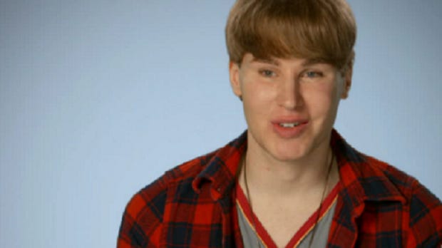 Toby Sheldon Man Who Spent To Look Like Justin Bieber Died From Multiple Drug Intoxication Toby Sheldon Man Who Spent To Look Like Justin Bieber Died From Multiple Drug Intoxication