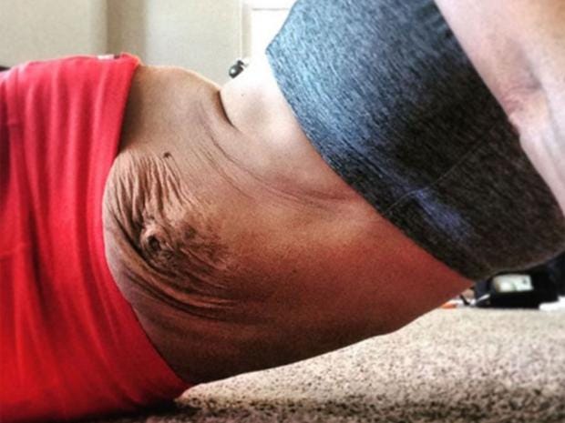 Athlete and mother praised for sharing photo of her stretch marks after