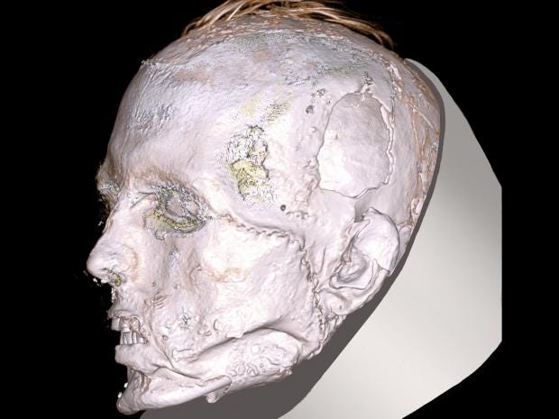 male-head-ct-scan.jpg