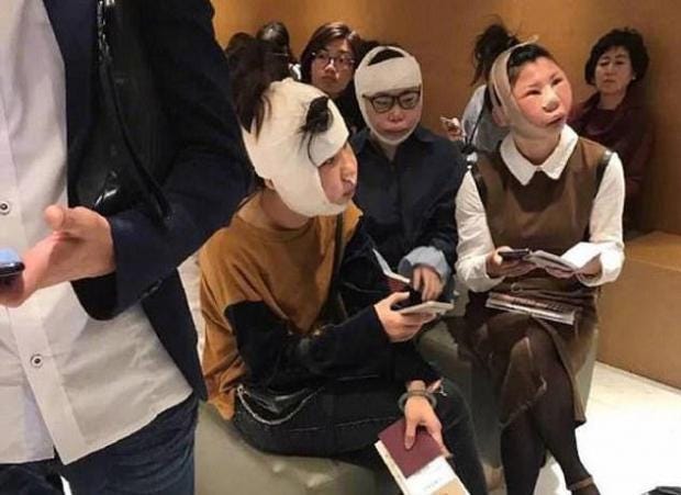 Αποτέλεσμα εικόνας για Women stranded at airport post plastic surgery as airport fails to confirm identity
