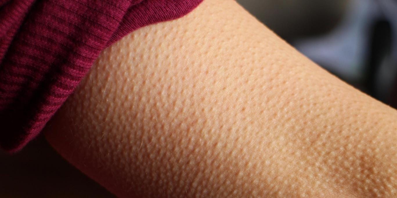 If music gives you goosebumps, your brain might be special Goose