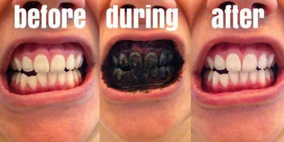 Here's why some people are brushing their teeth black 