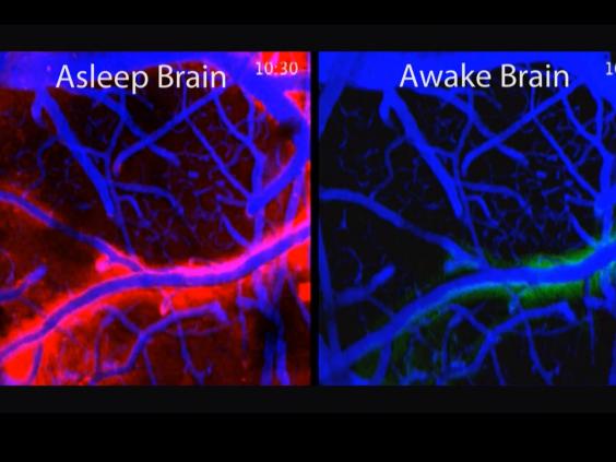 Sleep 'cleans' The Brain By Flushing Out Toxins | The Independent