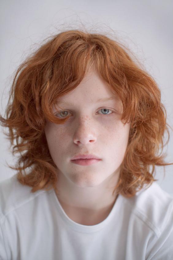 Photographer Fights Ginger Discrimination With Vivid Portraits Of 