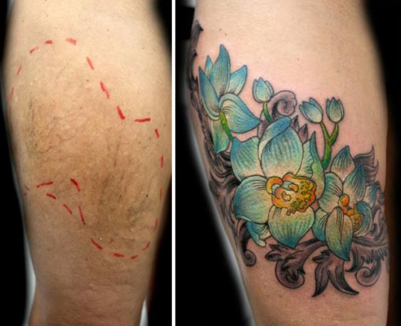 A tattoo artist is inking over the scars of victims of ...