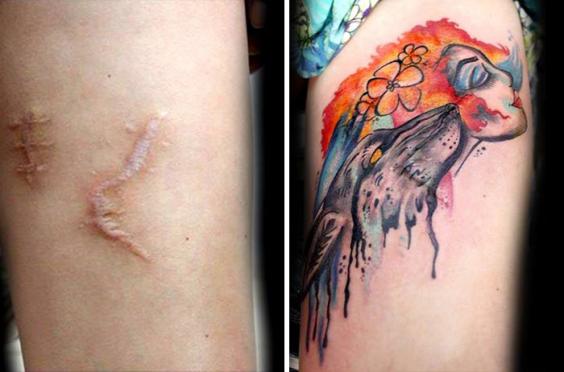 A Tattoo Artist Is Inking Over The Scars Of Victims Of Domestic