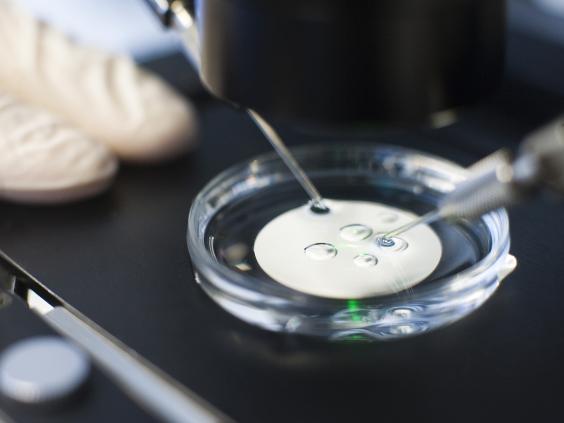 5-IVF-1-Rex.jpg 5-IVF-1-Rex.jpg