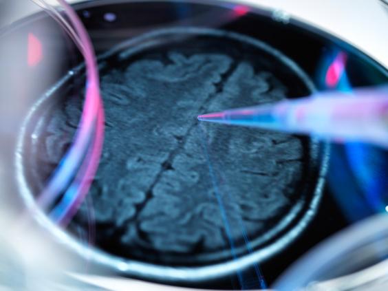 web-Alzheimers-1-RF-corbis.jpg web-Alzheimers-1-RF-corbis.jpg