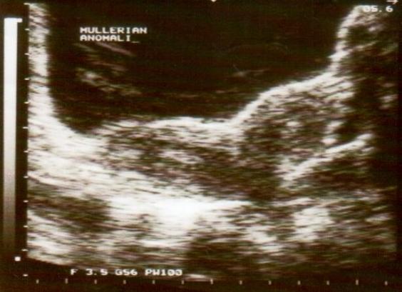 ultrasound-scan-nd-152.jpg