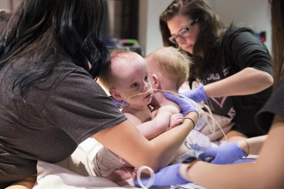 2k18-0049pvk-6784-conjoined-richards-twins-separation-surgery-photo-by-paul-vincent-kuntz.jpg