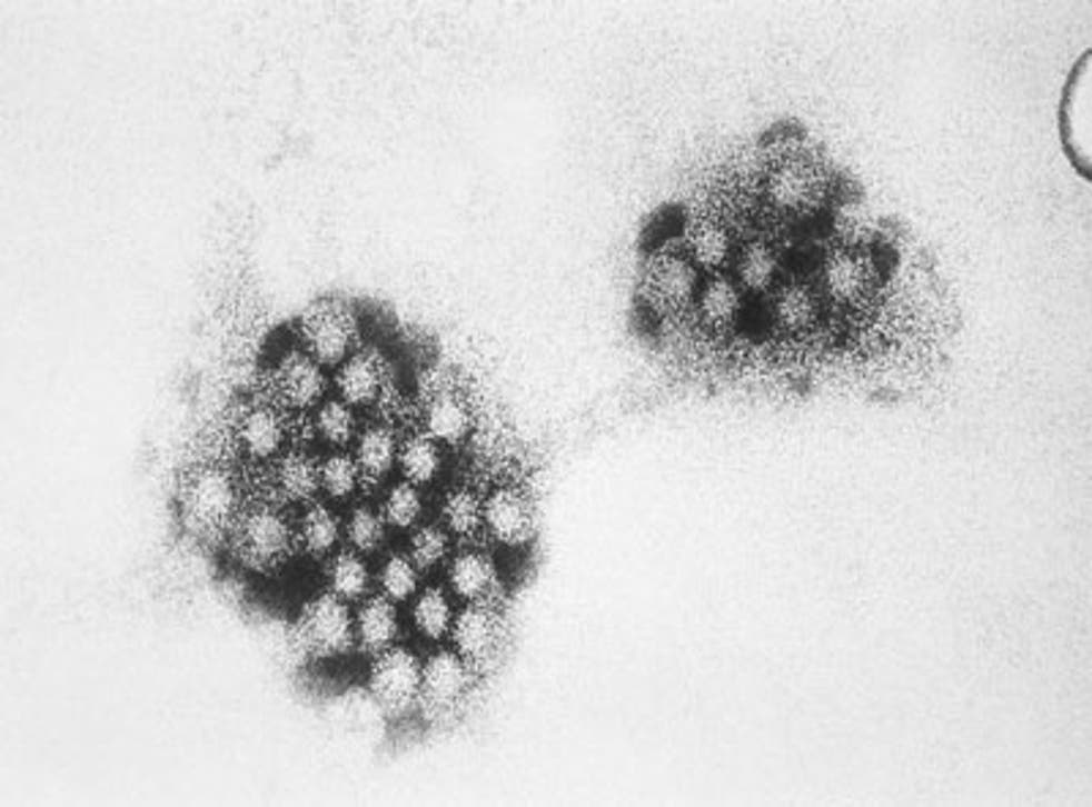 A team at the University of Arizona, Tucson found that when a virus, for example the norovirus, contaminates a single doorknob or elevator button it spreads rapidly through entire office buildings, hotels or hospitals.