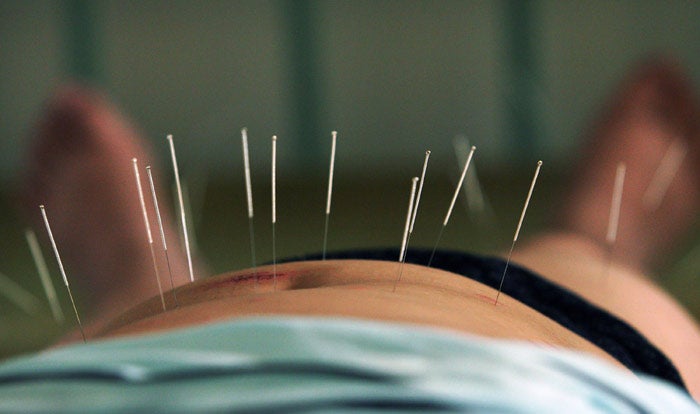 Acupuncture is thought to stimulate blood flow to the uterus and boost the production of endogenous opioids, inducing the body to relax