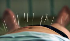 Acupuncture may increase chances of success in IVF