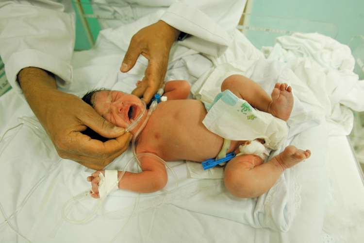 Researchers said premature babies were less likely to produce their own offspring