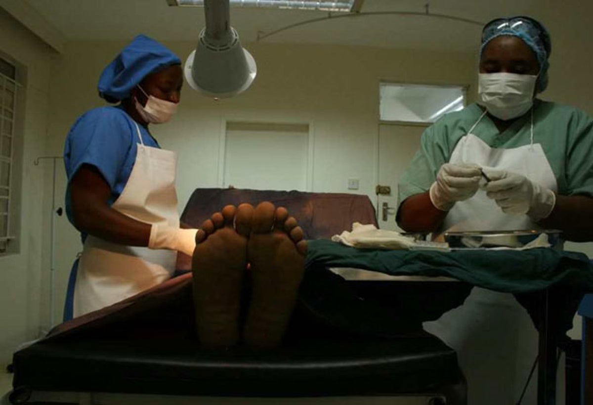 The kindest cut: How circumcision is the secret weapon in the battle  against HIV/Aids | The Independent | The Independent