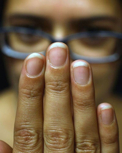 आने वाले भविष्य के संकेत देते हैं नाखूनों के सफेद धब्बे, जानिए कई रोचक  बातें | Nails also give good and bad signs | Patrika News