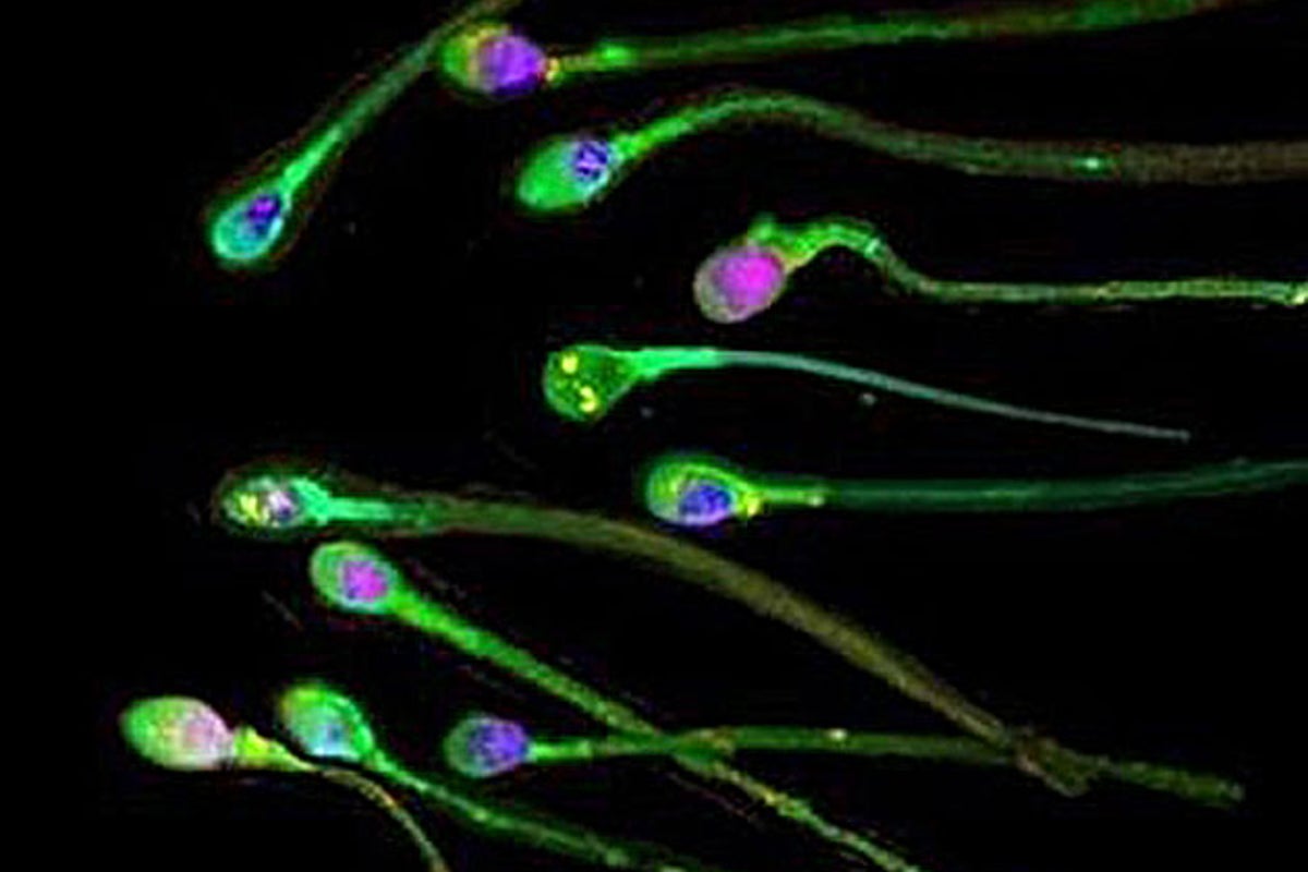 Sperm has a use-by date – new research reveals how abstinence harms male fertility