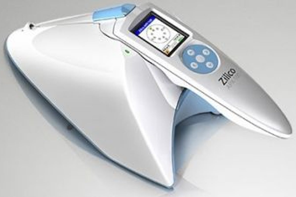 A device for rapid cervical screening could replace pap smears | The ...