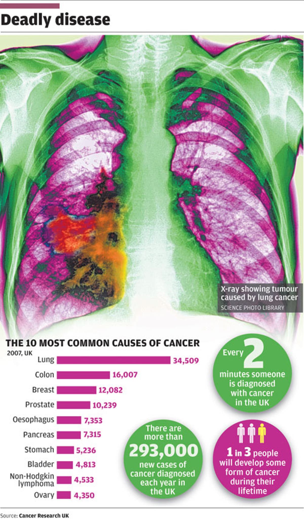 The Big Question: Has a key breakthrough been made in the search for a cure  for cancer?, The Independent