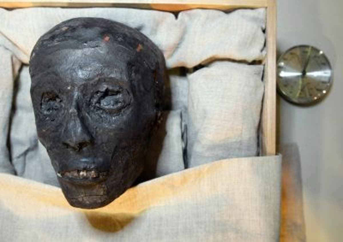 King Tut likely had club foot, killed by malaria: study | The ...