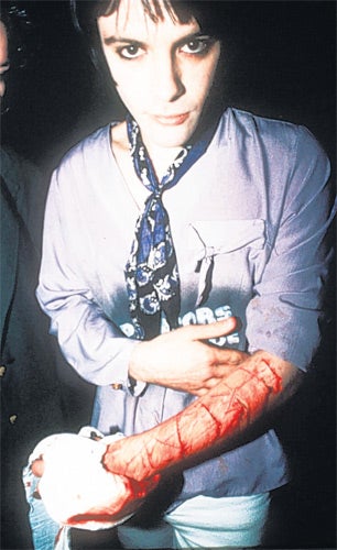 Richey Evans carved ‘4REAL’ into his arm in 1991