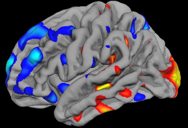 The questionnaire was developed as a way a quickly assessing where someone is likely to fall on the spectrum of traits associated with the childhood developmental condition