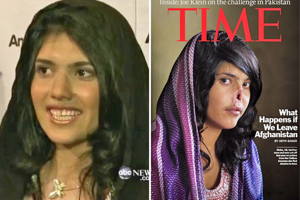 New face, and a new smile, for girl who felt the Taliban's wrath | The ...