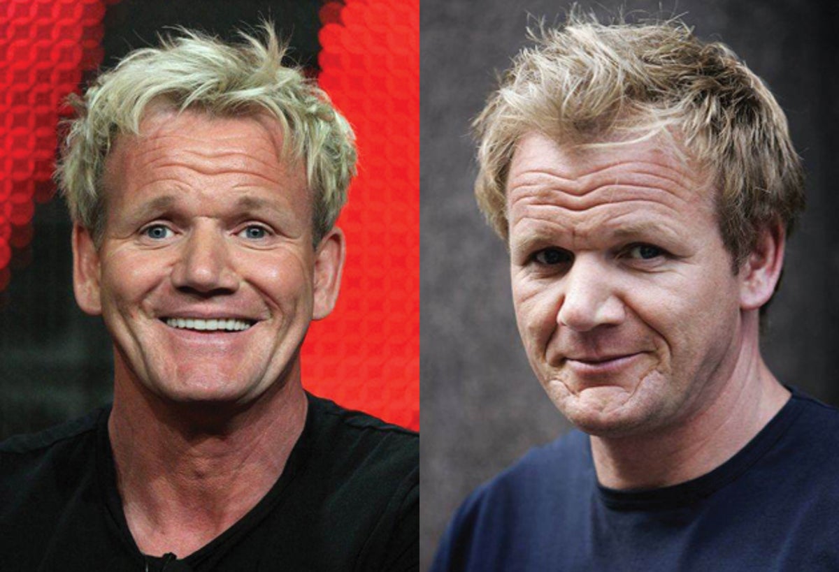 Gone today, hair tomorrow: chef Ramsay has £30,000 transplant | The  Independent | The Independent