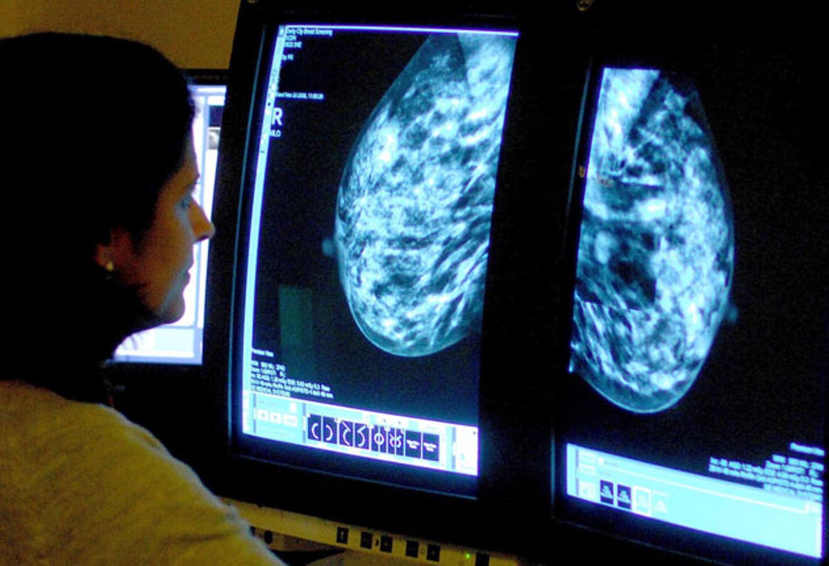 AstraZeneca hails ‘groundbreaking’ results of new breast cancer drug trial