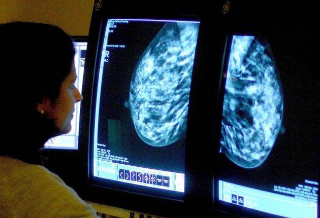 Rsearch has shown breast cancer can be broken down into 10 subtypes
