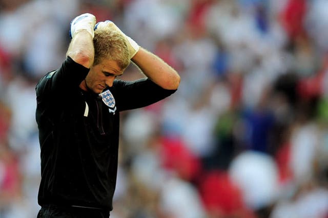 Hart is now England's only senior goalkeeper