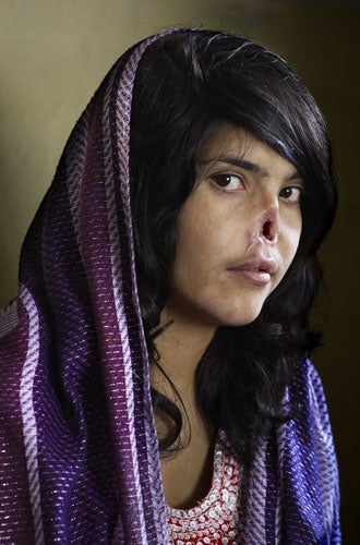 Winning image by Jodi Bieber, South Africa, Institute for Artist Management/Goodman Gallery for Time magazine.