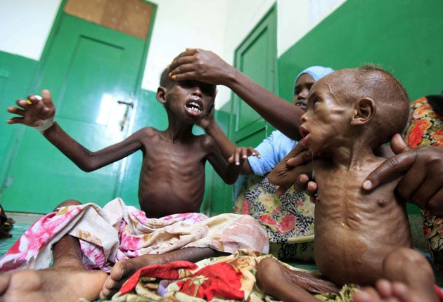 Starving Somali children in hospital in Mogadishu