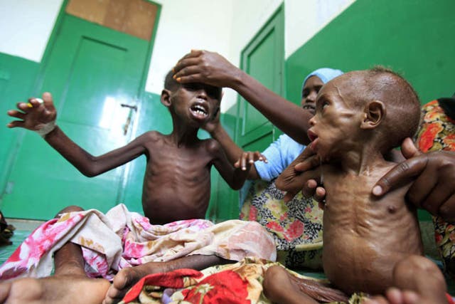 Starving Somali children in hospital in Mogadishu