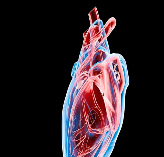 artificial heart diagram