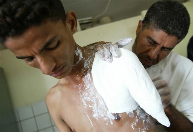 A victim in Iraq receives treatment