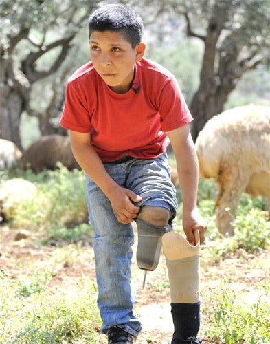 12-year-old Mohammad Abd el Aal lost a leg and an arm. In the past five years more than 50 people have been killed and 400 injured by unexploded bombs