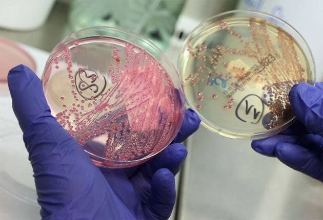 A lab technician holds a bacteria culture that shows an infection of
E.coli, one of the bacteria strains that can become superresistant to antibiotics