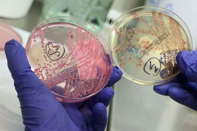 Cause of the E.coli infections still unknown 