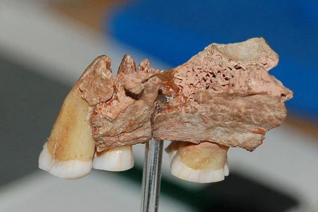 A fragment of the jawbone, with three teeth, discovered in Devon