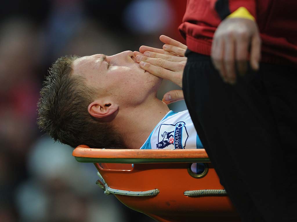 Connor Wickham was stretchered off against Manchester United