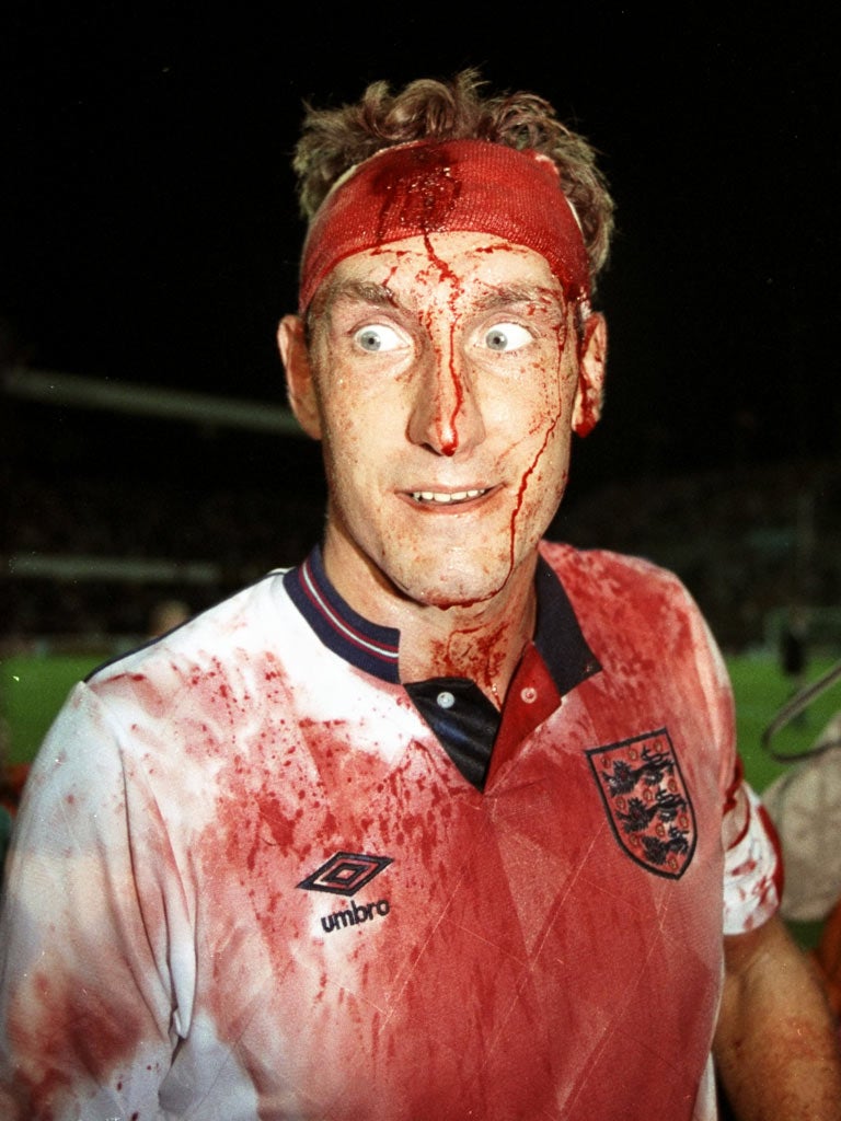 Terry Butcher gives blood for the cause in 1989