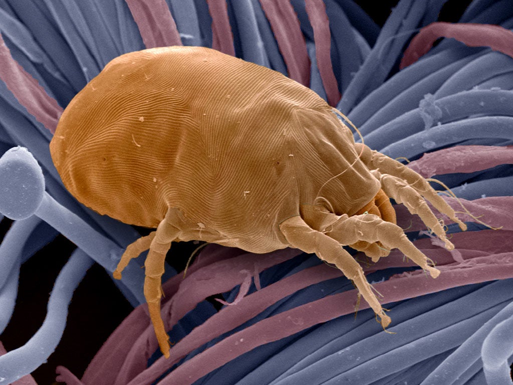 Dust mites are the unwanted company in bed