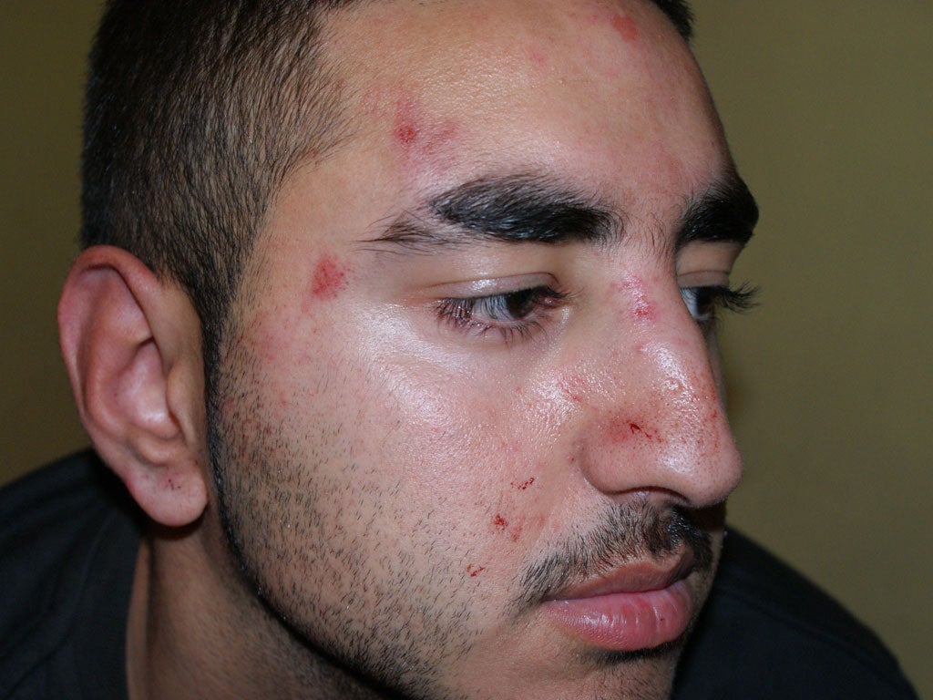 Ali Shahbazi shows his injuries in the aftermath of the attack