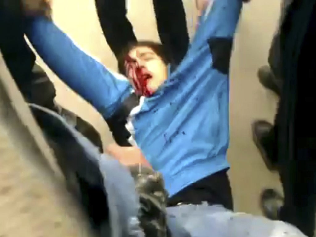 Amateur video footage showing a protester injured in clashes in Duma