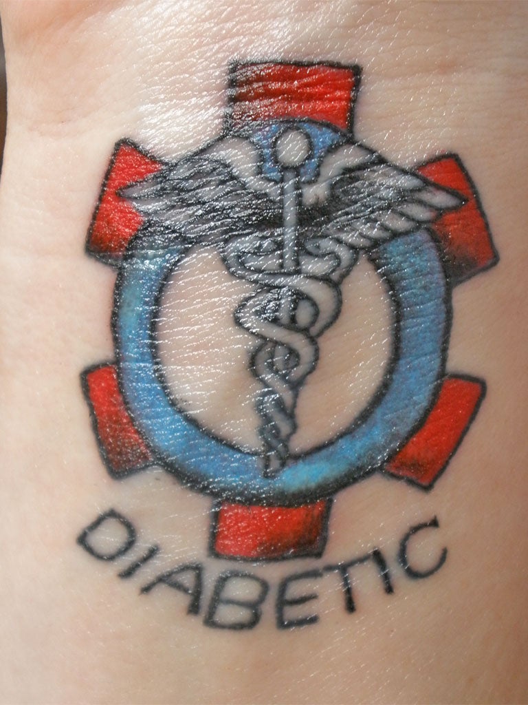 A diabetic 'medical tat'