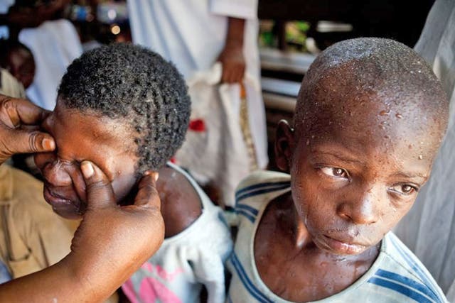 Thousands of children accused of being witches,
live on the streets of Kinshasa