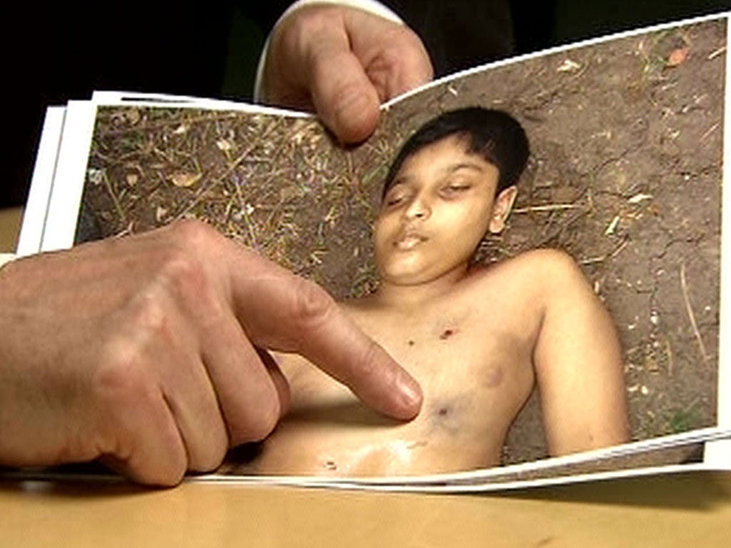 Derrick Pounder points out one of the five bulletwounds in the body of Balachandran Prabhakaran, 12, in Channel 4's Killing Fields