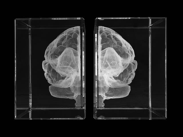 Portrait of the brain of the artist: inside Katharine Dowson's head
